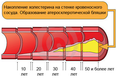 Схема распада триглицеридов в тканях